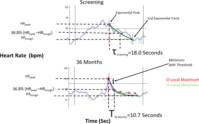 Chronic vagus nerve stimulation is associated with multi-year improvement in intrinsic heart rate recovery and left ventricular ejection fraction in ANTHEM-HF.
