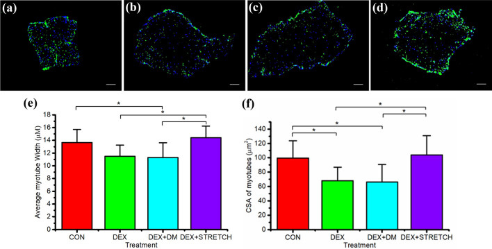 Mechanical loading of tissue engineered skeletal muscle prevents dexamethasone induced myotube atrophy.