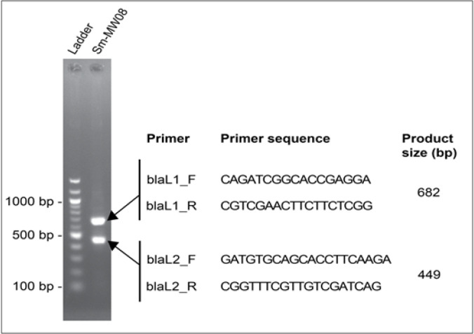 A multidrug-resistant <i>Stenotrophomonas maltophilia</i> clinical isolate from Kamuzu Central Hospital, Malawi.