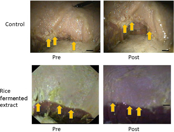 Effect of a novel rice fermented extract on gastric ulcers in horses.