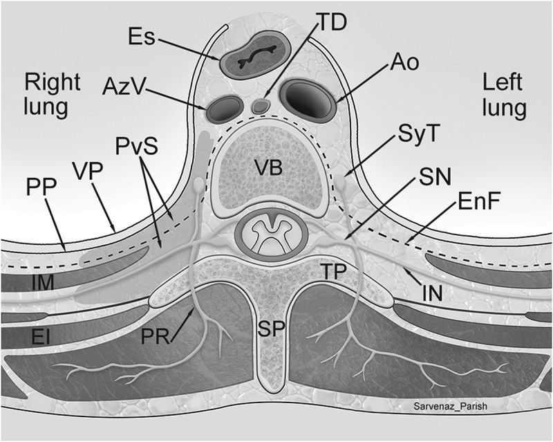 A Retrospective Cohort Study of Healthcare Utilization Associated with Paravertebral Blocks for Chronic Pain Management in Ontario.