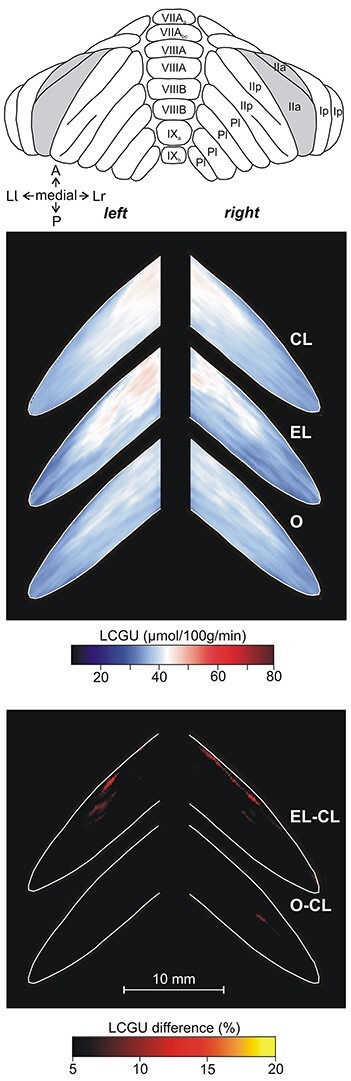 Functional Imaging of the Cerebellum during Action Execution and Observation.