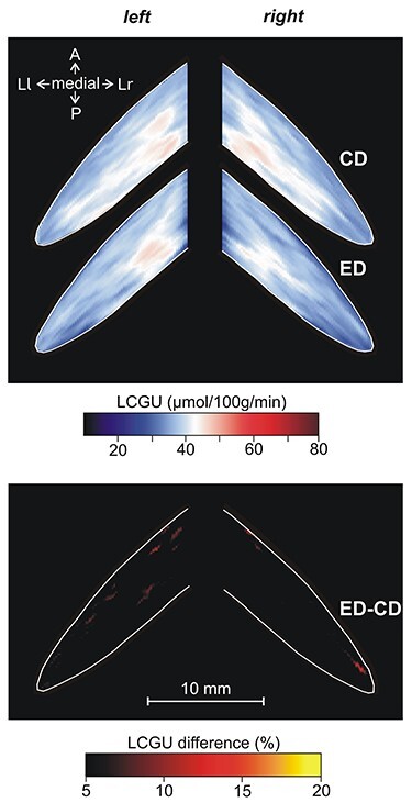 Functional Imaging of the Cerebellum during Action Execution and Observation.