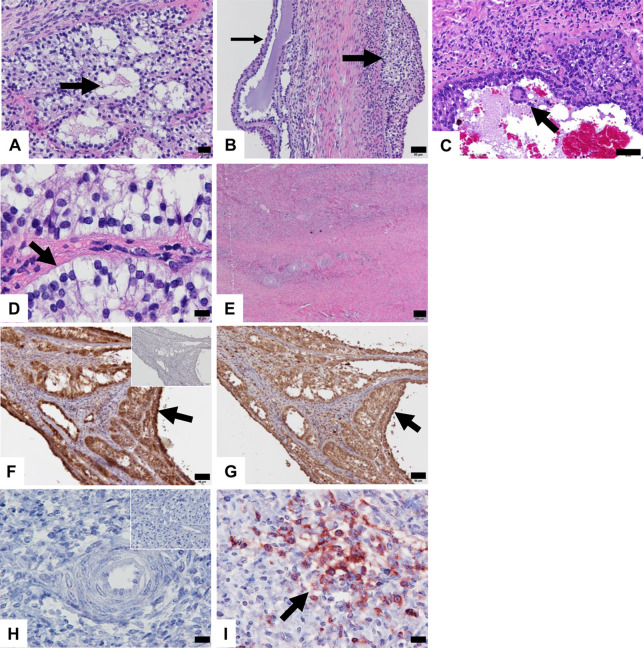 Case report: The case of a 17 kg ovarian granulosa cell tumor in a Breton draft mare.