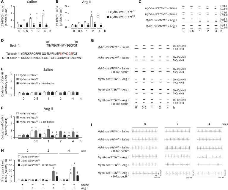 Insulin sensitization causes accelerated sinus nodal dysfunction through autophagic dysregulation in hypertensive mice.