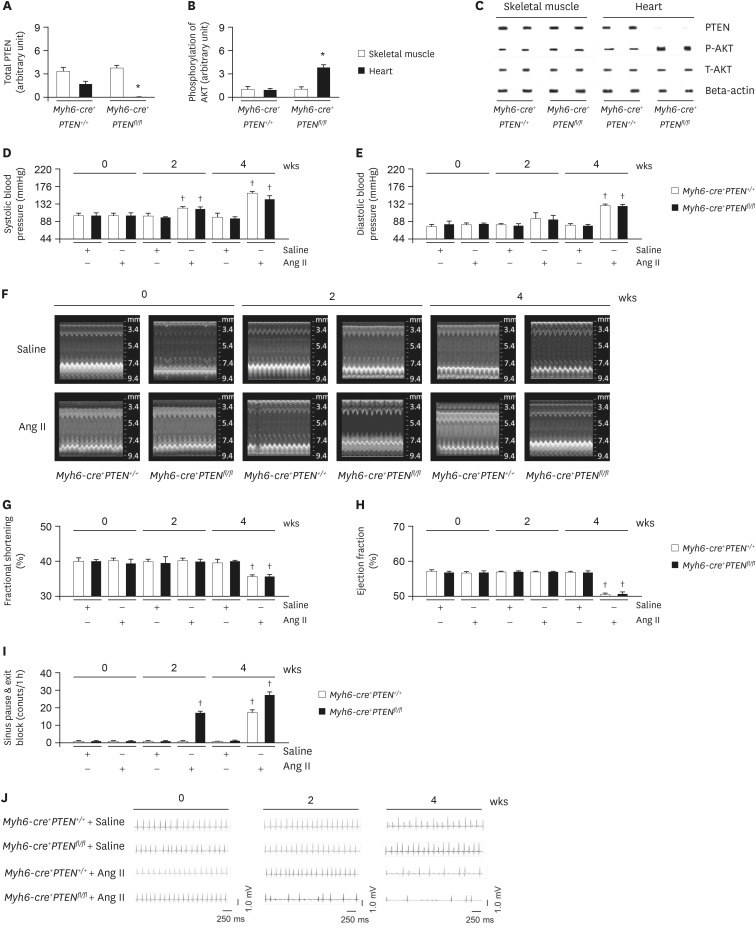 Insulin sensitization causes accelerated sinus nodal dysfunction through autophagic dysregulation in hypertensive mice.