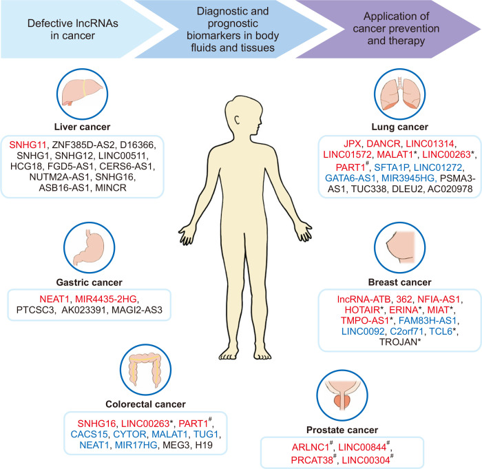 The Role of Sex-specific Long Non-coding RNAs in Cancer Prevention and Therapy.