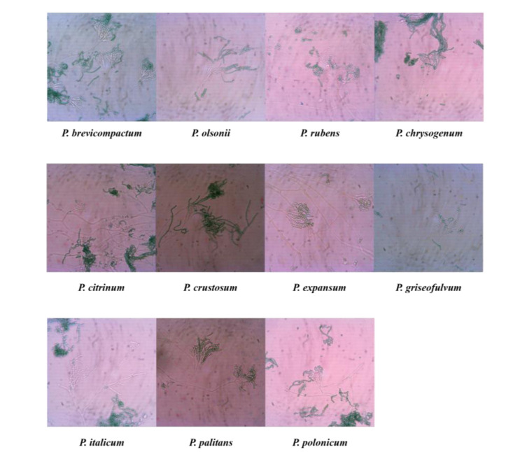 Phenotypic features and molecular study of airborne <i>Penicillium</i> species isolated in the northern part of the Persian Gulf, Bushehr, Iran.