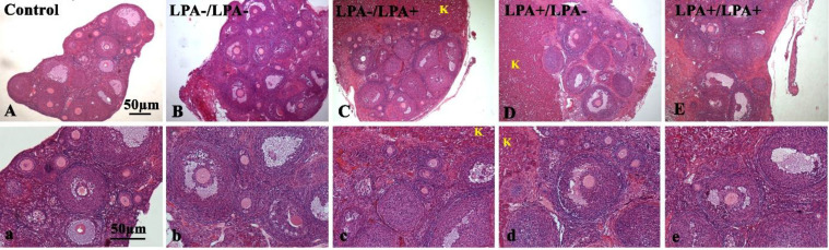 Effect of Lysophosphatidic Acid on the Vascular Endothelial Growth Factor Expression in Autotransplanted Mouse Ovaries Encapsulated in Sodium Alginate.