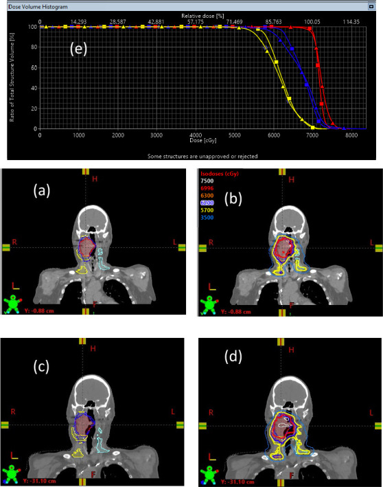 A Review of the Robust Optimization Process and Advances with Monte Carlo in the Proton Therapy Management of Head and Neck Tumors.