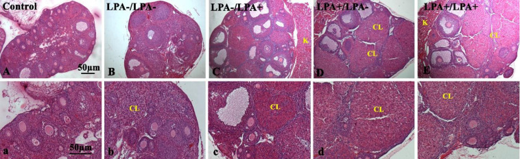 Effect of Lysophosphatidic Acid on the Vascular Endothelial Growth Factor Expression in Autotransplanted Mouse Ovaries Encapsulated in Sodium Alginate.