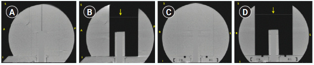 Use of GammaPlan convolution algorithm for dose calculation on CT and cone-beam CT images.