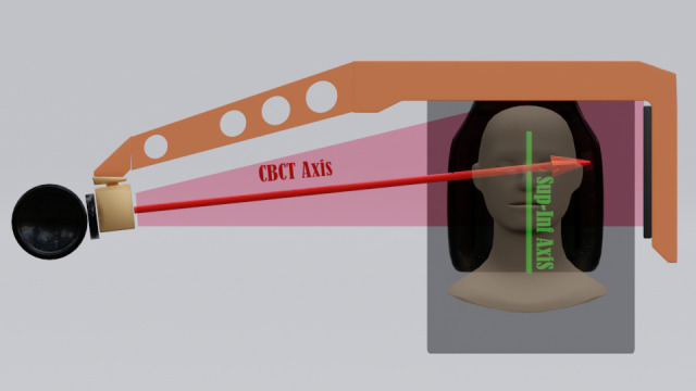 Use of GammaPlan convolution algorithm for dose calculation on CT and cone-beam CT images.