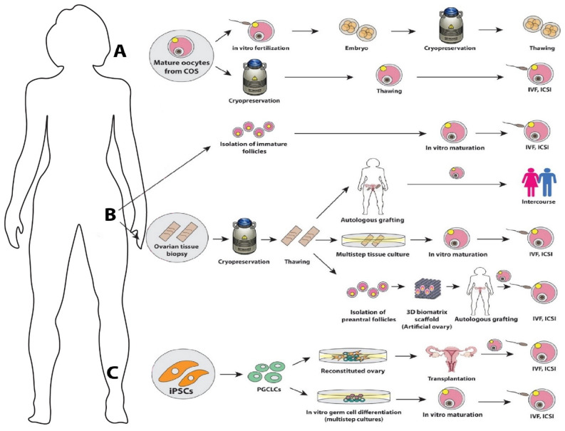 Recent advances: fertility preservation and fertility restoration options for males and females.