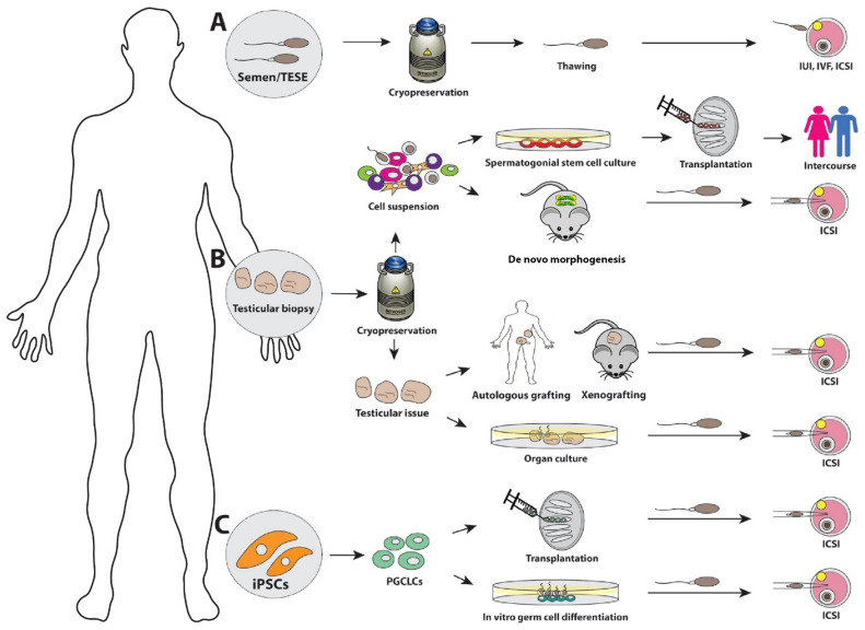 Recent advances: fertility preservation and fertility restoration options for males and females.