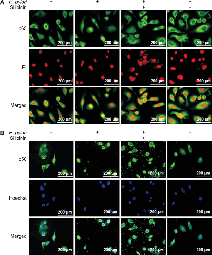 Protective Effects of Silibinin on <i>Helicobacter pylori</i>-induced Gastritis: NF-κB and STAT3 as Potential Targets.