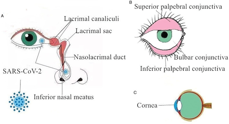 Keep Eyes on COVID-19: Ophthalmic Symptoms and Potential Transmission of SARS-CoV-2 through the Oculus.