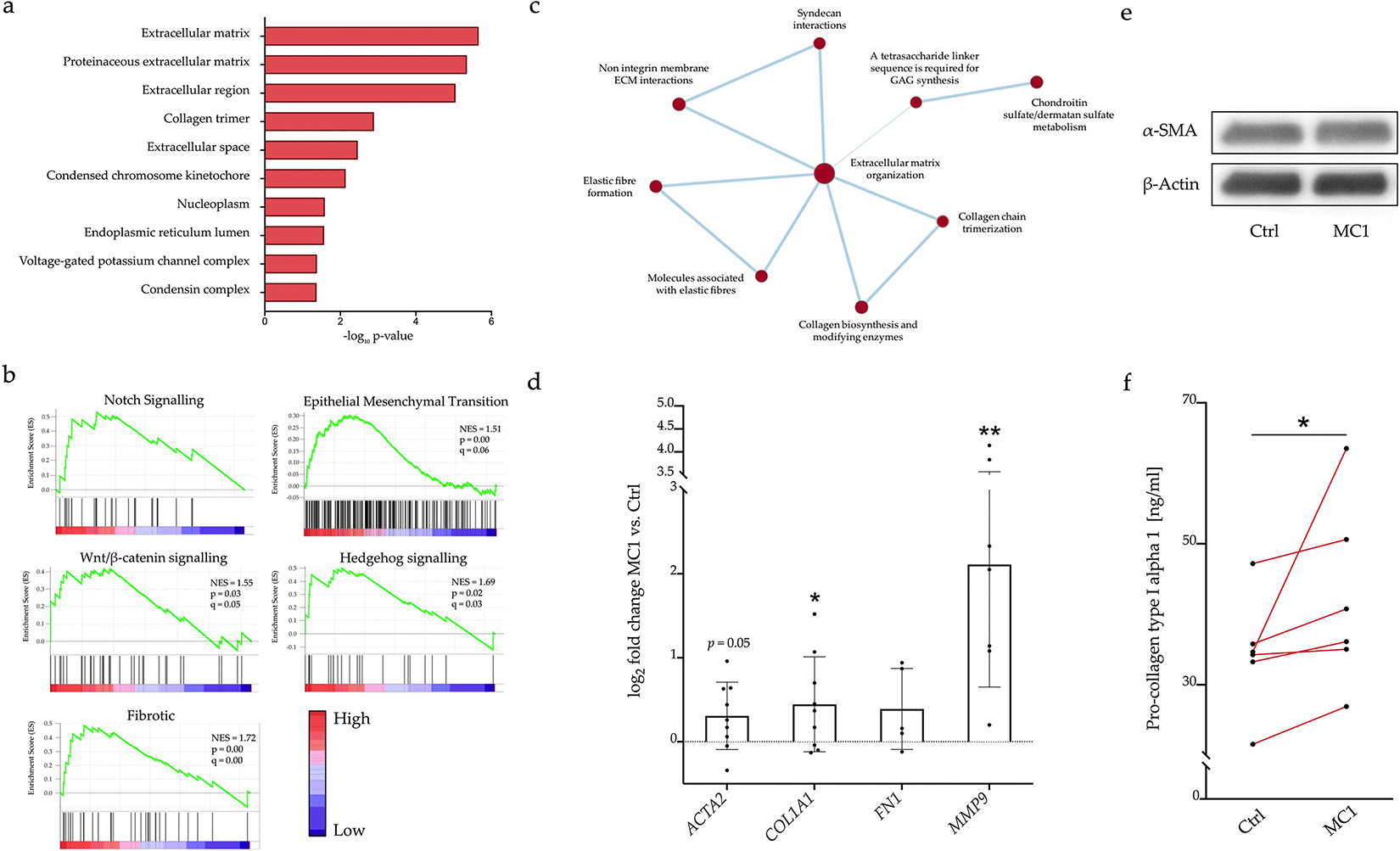 Pro-fibrotic phenotype of bone marrow stromal cells in Modic type 1 changes.