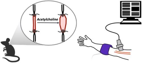 Anthracycline chemotherapy-mediated vascular dysfunction as a model of accelerated vascular aging