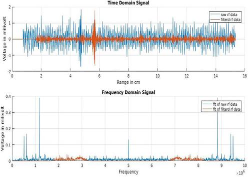 Design of a 128-channel transceiver hardware for medical ultrasound imaging systems