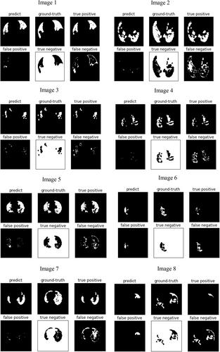 COVSeg-NET: A deep convolution neural network for COVID-19 lung CT image segmentation