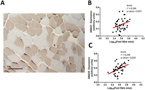 Altered H19/miR-675 expression in skeletal muscle is associated with low muscle mass in community-dwelling older adults