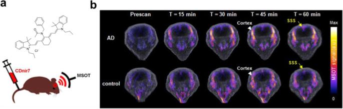 A brief review of non-invasive brain imaging technologies and the near-infrared optical bioimaging