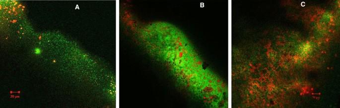 In vitro antibacterial effect of fifth generation dentin bonding agent incorporated with nisin on Streptococcus mutans