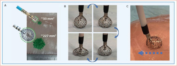 The Cutting Edge of Atrial Fibrillation Ablation.