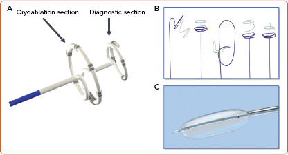 The Cutting Edge of Atrial Fibrillation Ablation.