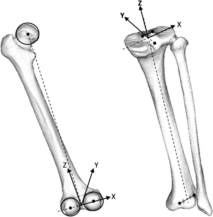 Comparison of post-operative three-dimensional and two-dimensional evaluation of component position for total knee arthroplasty.