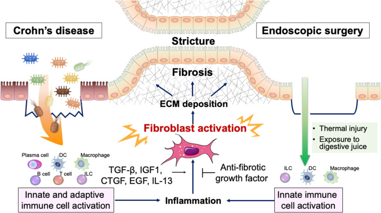 Pathogenesis and management of gastrointestinal inflammation and fibrosis: from inflammatory bowel diseases to endoscopic surgery.