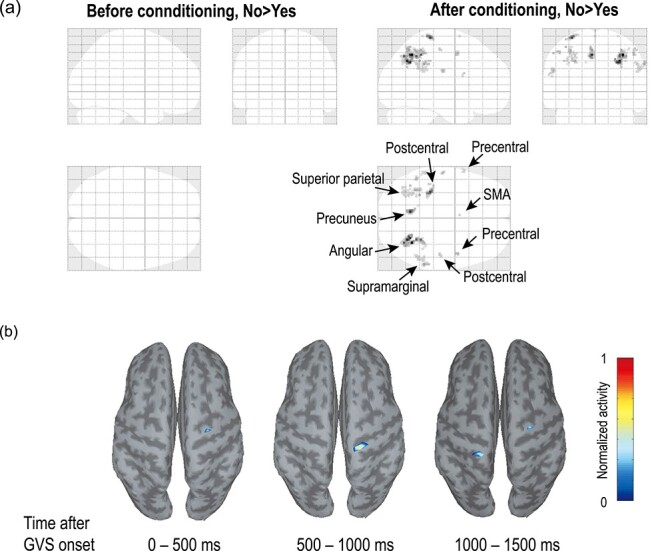 Binary Semantic Classification Using Cortical Activation with Pavlovian-Conditioned Vestibular Responses in Healthy and Locked-In Individuals.