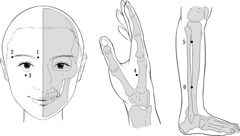 Laser Acupuncture Improves Tear Film Stability in Patients with Dry Eye Disease: A Two-Center Randomized-Controlled Trial.