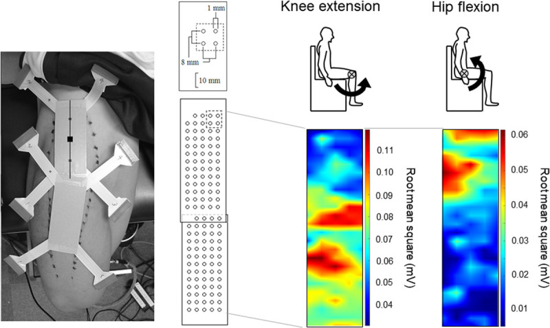 Novel Insights Into Biarticular Muscle Actions Gained From High-Density Electromyogram.