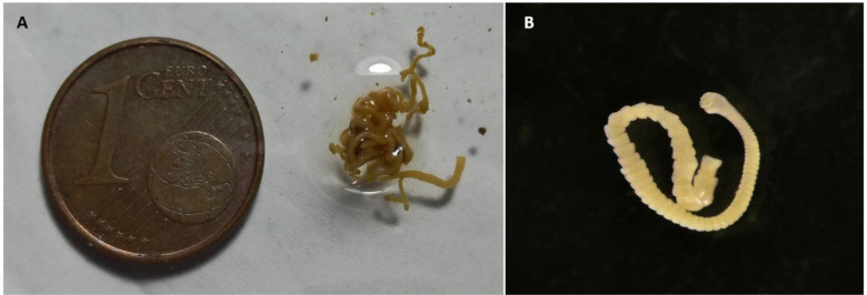 First Report of <i>Passerilepis parina</i> (Cestoda: Hymenolepididae) from <i>Parus major</i> in Iran: A Probable Fatal Case Due to Hyperinfection.