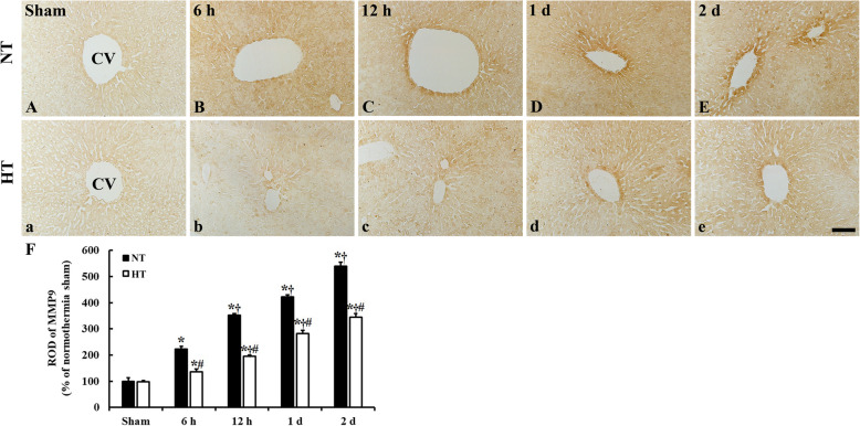 Hypothermic treatment reduces matrix metalloproteinase-9 expression and damage in the liver following asphyxial cardiac arrest in rats.