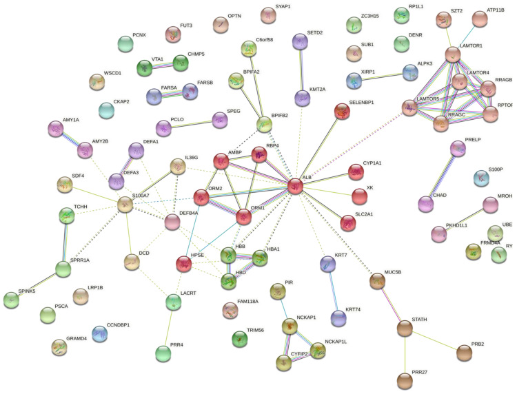 Downregulation of Salivary Proteins, Protective against Dental Caries, in Type 1 Diabetes.