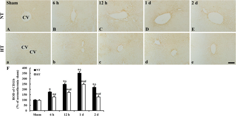 Hypothermic treatment reduces matrix metalloproteinase-9 expression and damage in the liver following asphyxial cardiac arrest in rats.