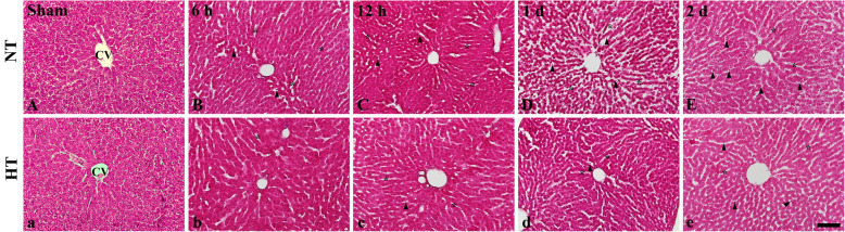 Hypothermic treatment reduces matrix metalloproteinase-9 expression and damage in the liver following asphyxial cardiac arrest in rats.