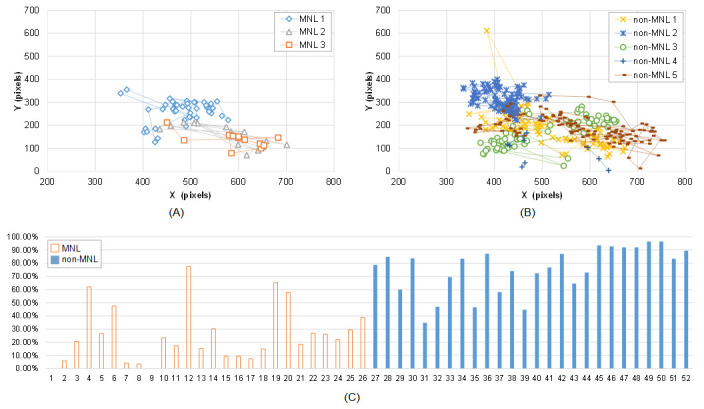 Detecting Task Difficulty of Learners in Colonoscopy: Evidence from Eye-Tracking.