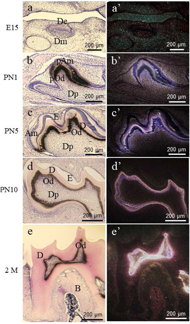 Dentine sialophosphoprotein signal in dentineogenesis and dentine regeneration.