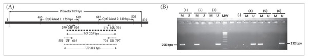 Simultaneously Both Expression of <i>LMP-1</i> and Methylation of <i>E-cadherin</i>: Molecular Biomarker in Stage IV of Nasopharyngeal Carcinoma Patients.