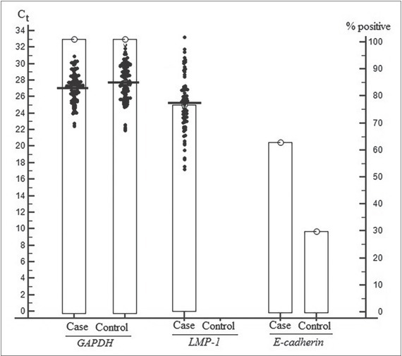 Simultaneously Both Expression of <i>LMP-1</i> and Methylation of <i>E-cadherin</i>: Molecular Biomarker in Stage IV of Nasopharyngeal Carcinoma Patients.