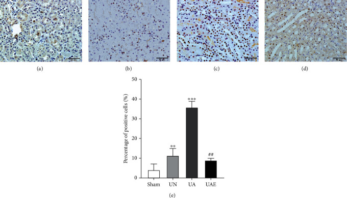 Aldosterone Induces the Proliferation of Renal Tubular Epithelial Cells <i>In Vivo</i> but Not <i>In Vitro</i>.