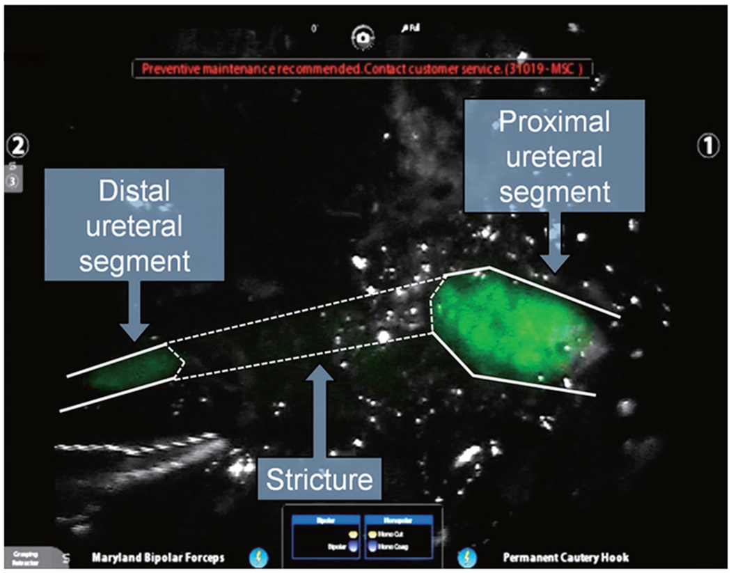 A narrative review of fluorescence imaging in robotic-assisted surgery.