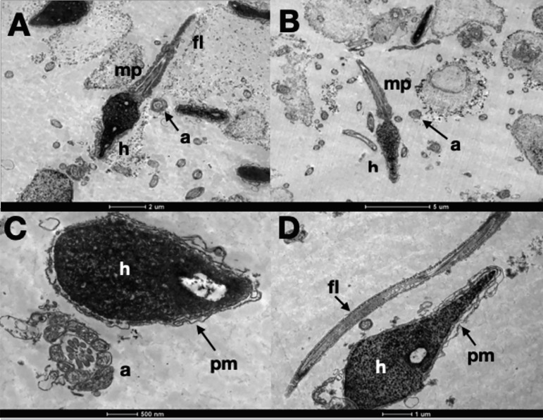 Ultrastructural analysis of Lyophilized Human Spermatozoa.