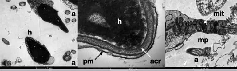 Ultrastructural analysis of Lyophilized Human Spermatozoa.