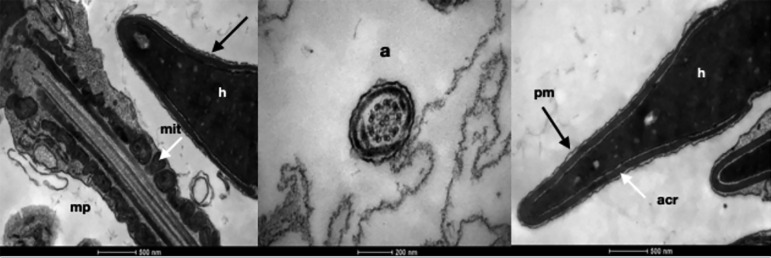 Ultrastructural analysis of Lyophilized Human Spermatozoa.