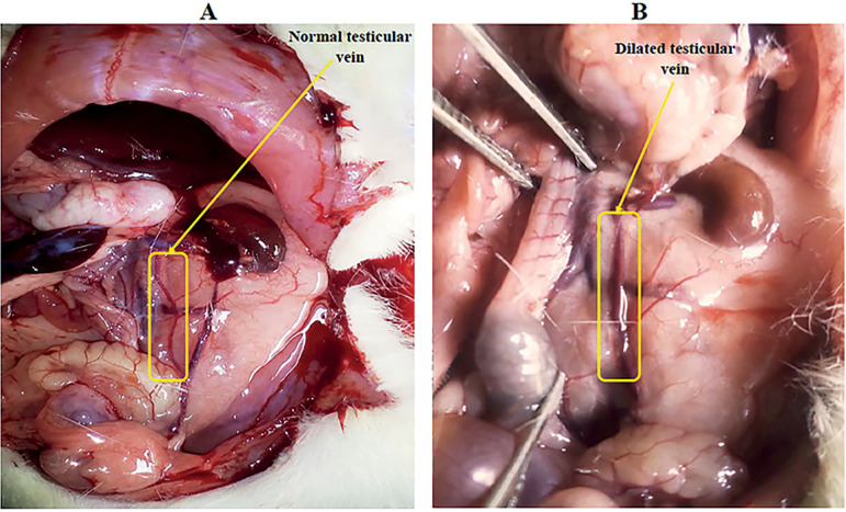Dracaena arborea improves sperm characteristics and antioxidant enzymes in adult male rats with experimental varicocele.